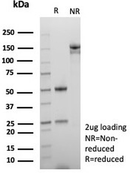 ROS1 Antibody