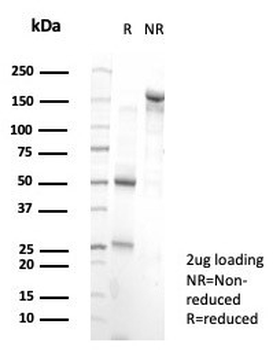 PRDM1 Antibody / BLIMP1