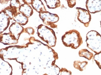 hCG-alpha Antibody / Luteinizing Hormone alpha
