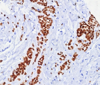 ER alpha Antibody / Estrogen Receptor alpha