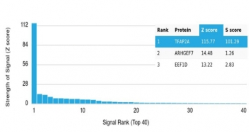 AP2 alpha Antibody / TFAP2A / Activator protein 2
