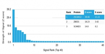 ZSCAN12 Antibody