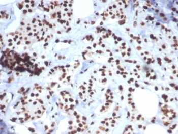 Heat shock 70 kDa protein 1B Antibody / HSP70 / HSPA1B