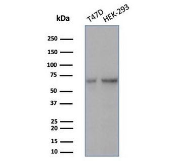 Heat shock 70 kDa protein 1B Antibody / HSP70 / HSPA1B