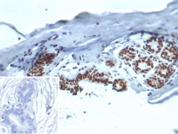 Heat shock 70 kDa protein 1B Antibody / HSP70 / HSPA1B