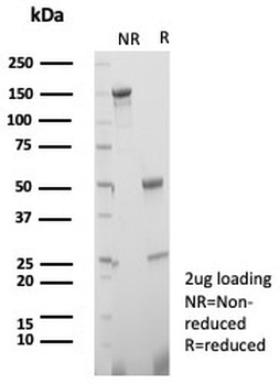 Heat shock 70 kDa protein 1B Antibody / HSP70 / HSPA1B