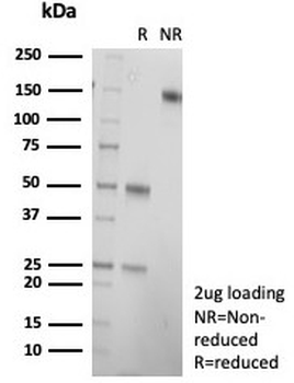 HCG-alpha Antibody