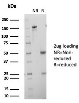 HCG-alpha Antibody