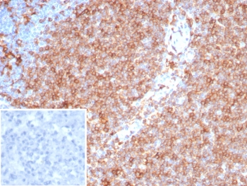 Pan-HLA Antibody MHC II (DP/DQ/DR)