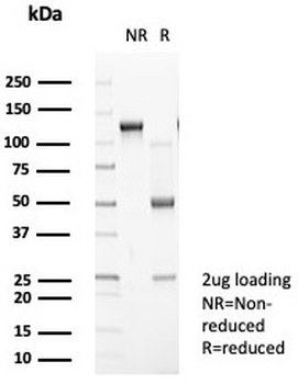 Pan-HLA-II Antibody / HLA-DP/DQ/DR