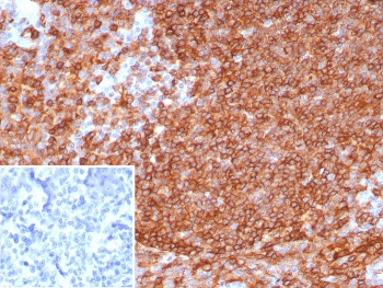 HLA-DR Antibody (MHC II)