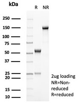 HLA-DR Antibody (MHC II)