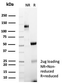 HLA-ABC Antibody / MHC I