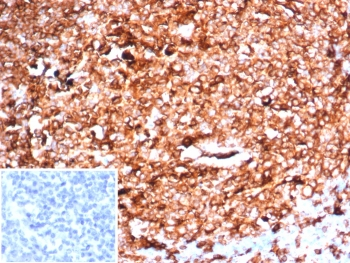 HLA-DR Antibody (MHC II)