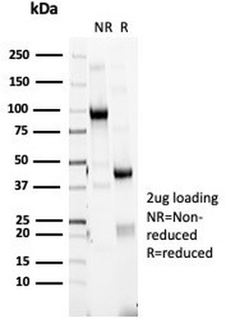 HLA-DR Antibody (MHC II)