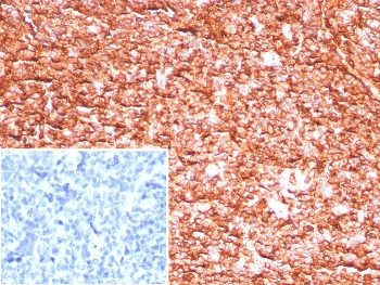 HLA-ABC Antibody / MHC I