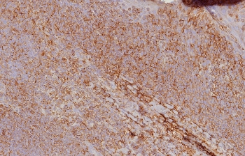 HLA-ABC Antibody / MHC I