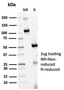HLA-DR Antibody (MHC II)