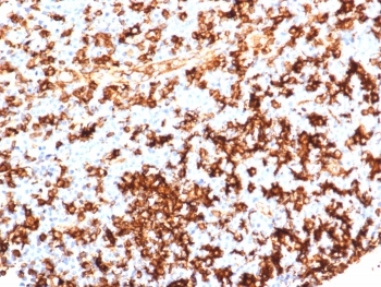 HLA-DR Antibody (MHC II)