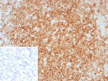 HLA-DR Antibody (MHC II)