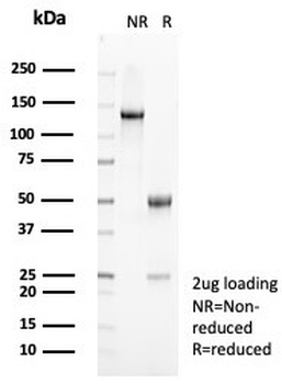 HLA-DR Antibody (MHC II)