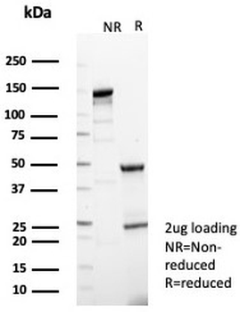 BTBD9 Antibody / BTB/POZ domain-containing protein 9