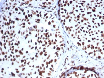 HSP70-2 Antibody / HSPA1B
