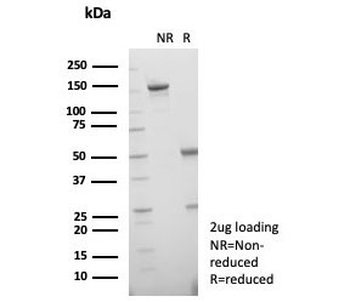 HSP70-2 Antibody / HSPA1B