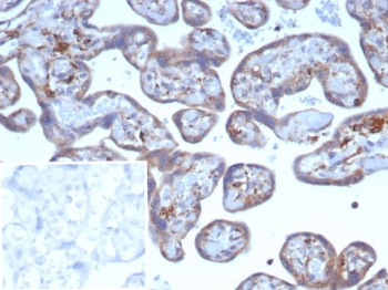 VEGF Antibody / Vascular Endothelial Growth Factor