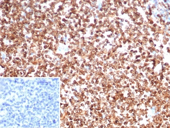 CD74 Antibody / CLIP