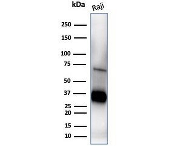 CD74 Antibody / CLIP