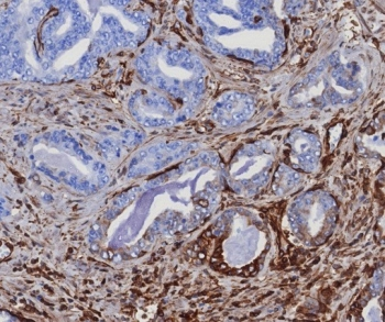 STING1 Antibody / TMEM173 / ERIS / MITA