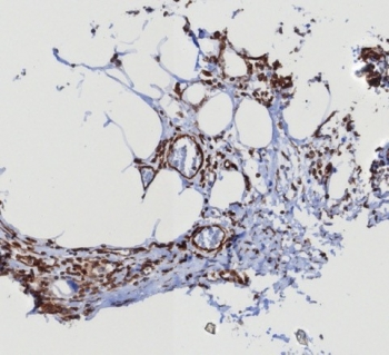STING1 Antibody / TMEM173 / ERIS / MITA