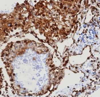 STING1 Antibody / TMEM173 / ERIS / MITA