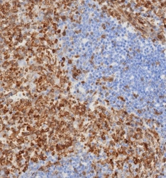 STING1 Antibody / TMEM173 / ERIS / MITA