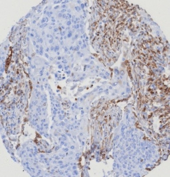 STING1 Antibody / TMEM173 / ERIS / MITA