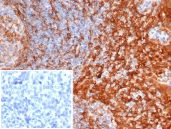 STING1 Antibody / TMEM173 / ERIS / MITA