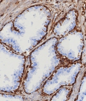 STING1 Antibody / TMEM173 / ERIS / MITA
