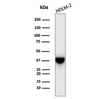 STING1 Antibody / TMEM173 / ERIS / MITA