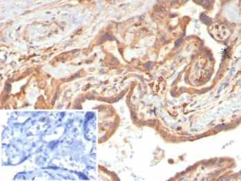 VEGF Antibody / Vascular Endothelial Growth Factor