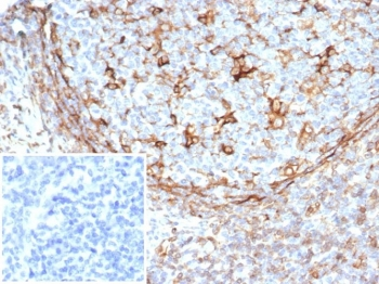STING1 Antibody / TMEM173 / ERIS / MITA