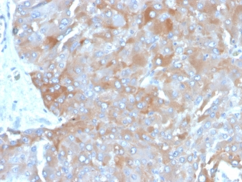 IL-3 Antibody