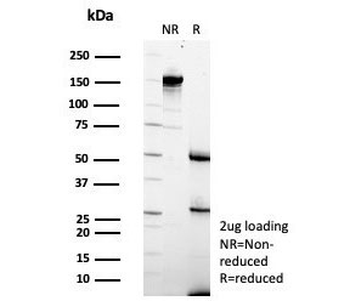 TCF7 Antibody / Transcription Factor 7