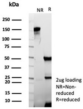 OCLN Antibody / Occludin