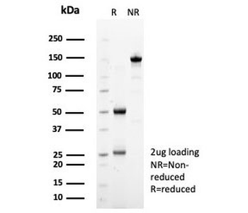 SDHA Antibody