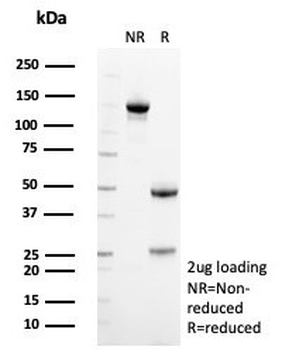 SDHA Antibody