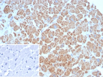 SDHA Antibody