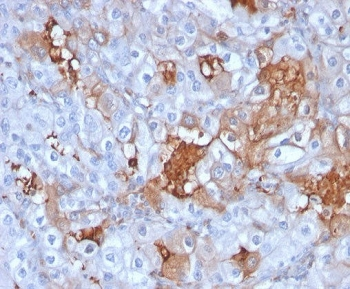 K-Cadherin Antibody / CDH6