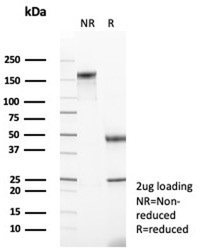 Mineralocorticoid Receptor Antibody / MR / NR3C2