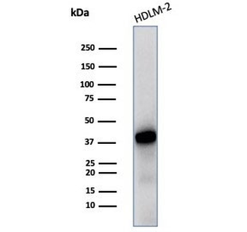 STING1 Antibody / TMEM173 / ERIS / MITA